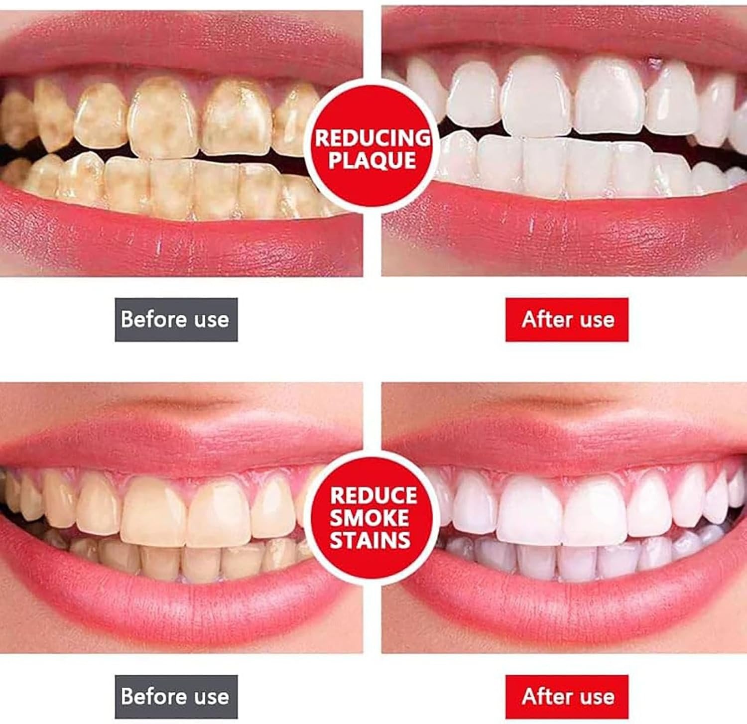 120g SP-4 Probiotic Toothpaste – Whitening, Fresh Breath & Stain Removal | Complete Tooth Care Toothpaste - Image 4