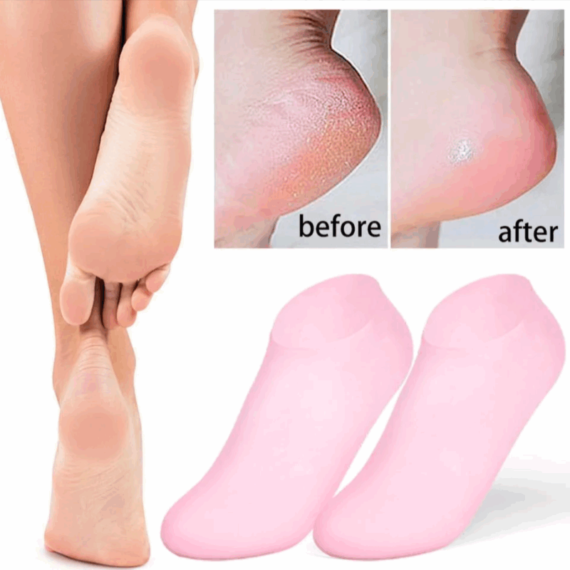 ( Buy 1 Get 1 Free ) Silicone Gel Heel Pad Socks – Pain Relief & Anti-Crack Heel Protectors, Heel Cups & Cushioned Sleeves for Men & Women